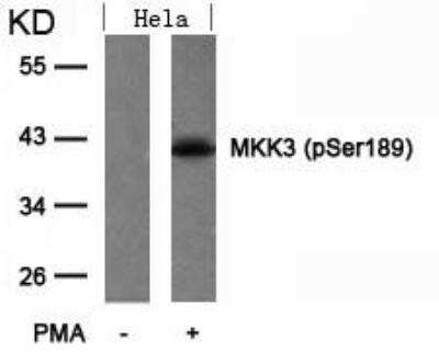Western Blot: MKK3/MEK3 [p Ser189] Antibody [NB100-82048]